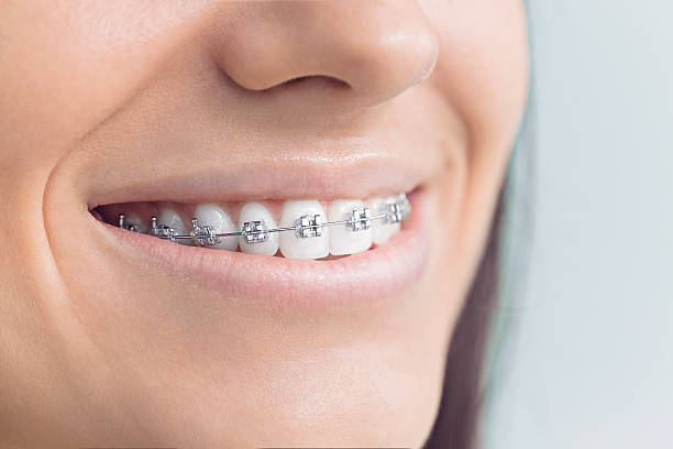 Best Full Mouth Reconstruction  in Needles, CA